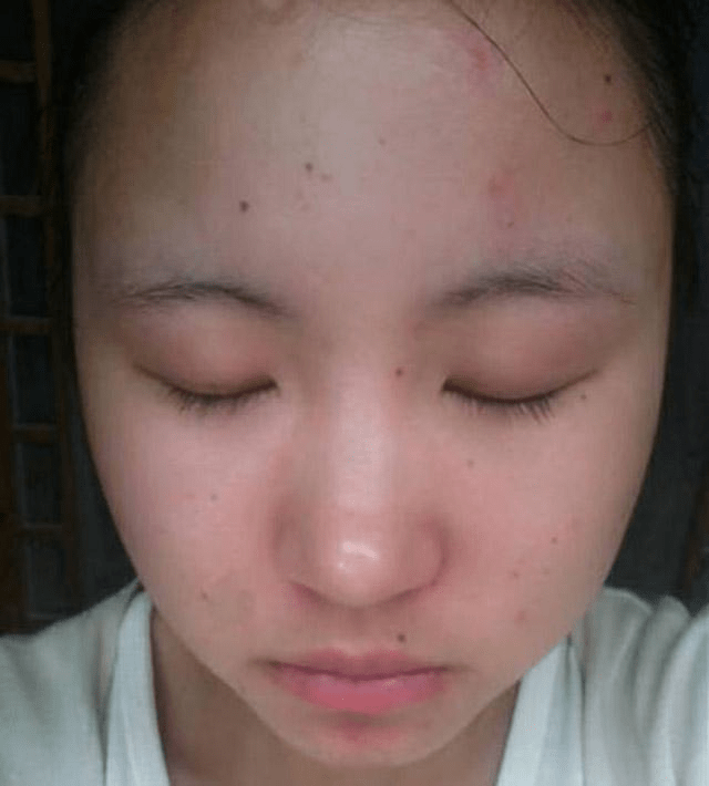 补硒伤害肝脏吗吗