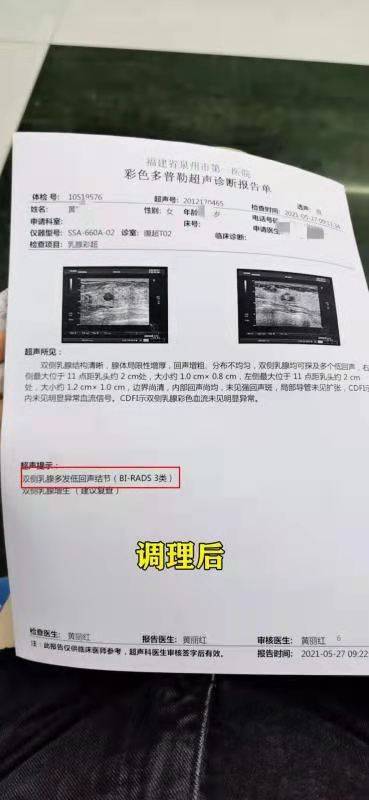 乳腺结节怎样补硒