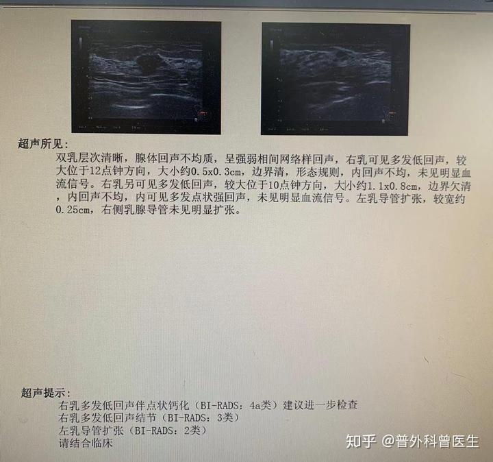 乳腺结节怎样补硒