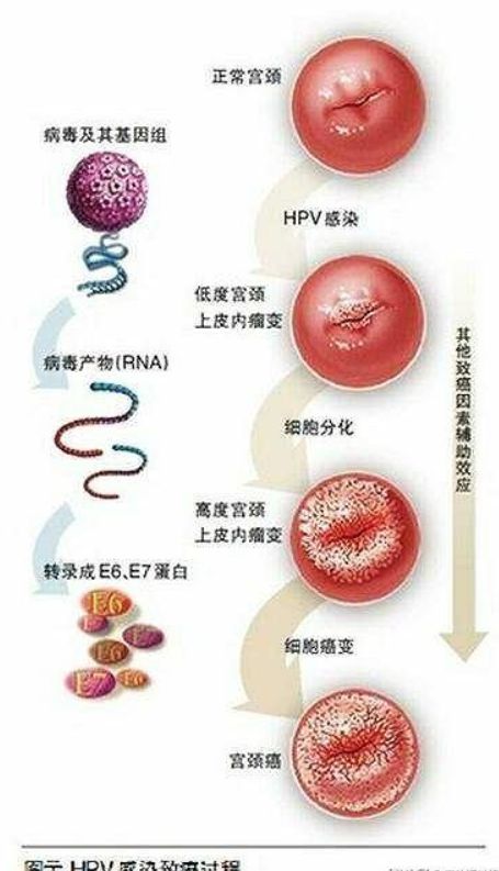 hpv高危阳补硒
