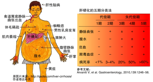 肝病为什么要补硒(补硒治愈了我的肝?。?硒宝网