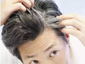 补硒可以防白发吗