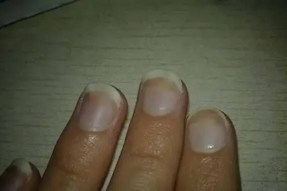 肝脏不好要补硒吗