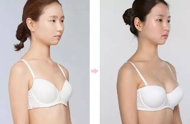 补硒能治疗皮炎吗