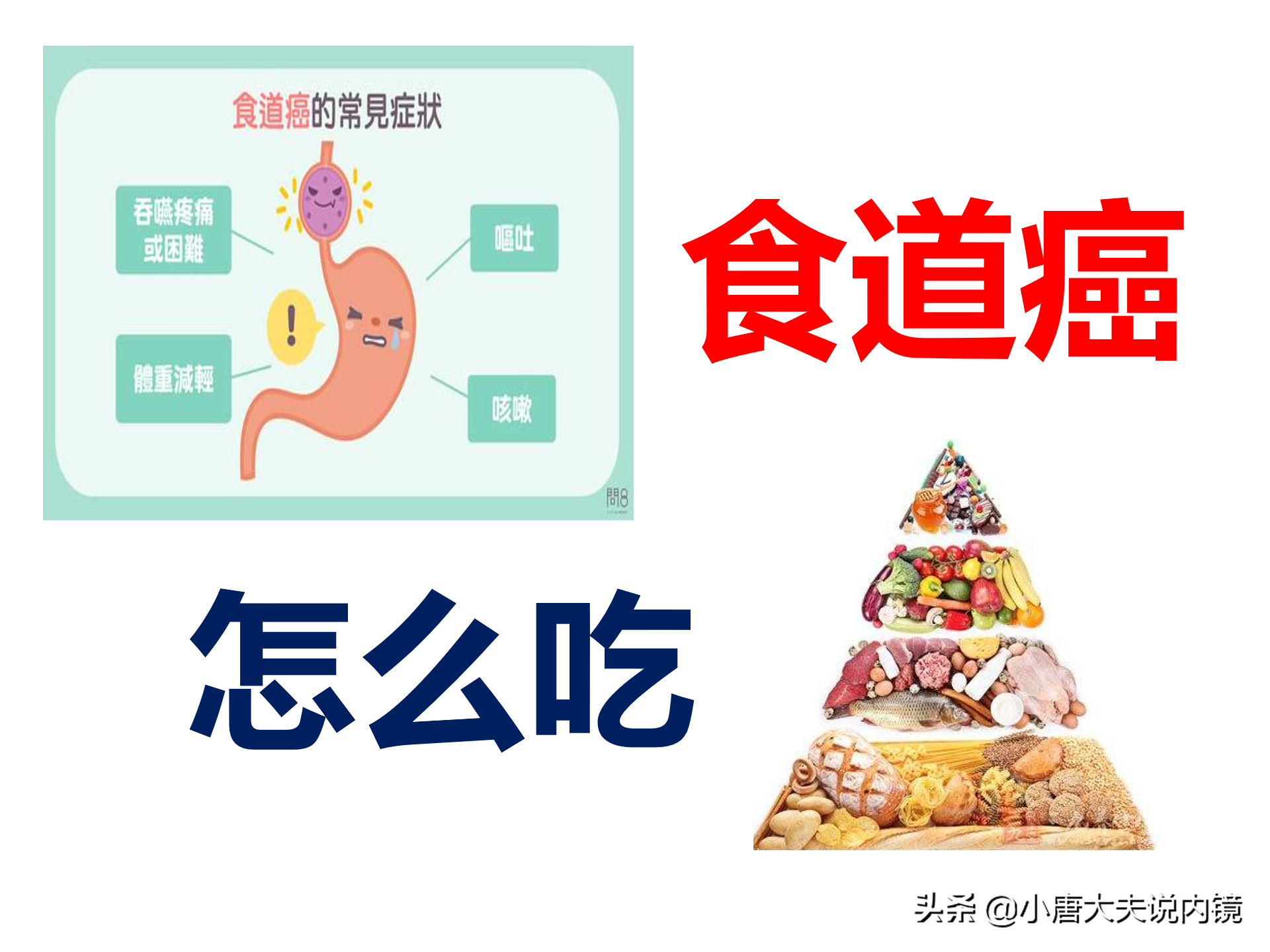 食道癌补硒能好吗(癌症患者可以吃硒吗)-硒宝网