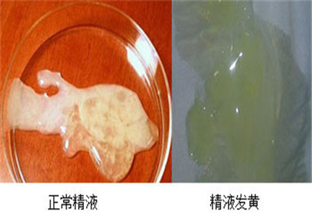 甲减为什么会补硒