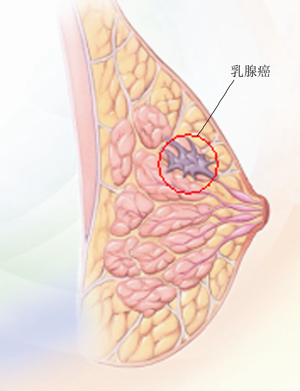 乳腺癌补硒的水果