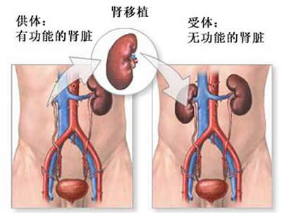 肾脏病人能补硒吗
