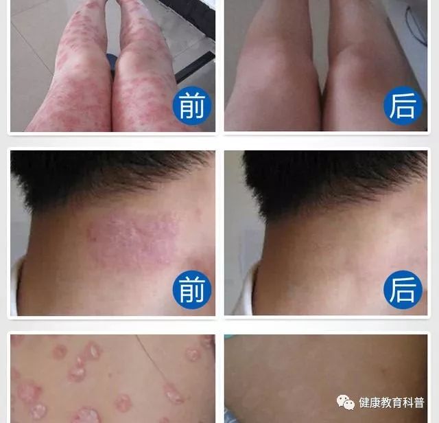 科学补硒心得体会