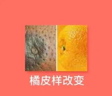 补硒能防卵巢癌吗