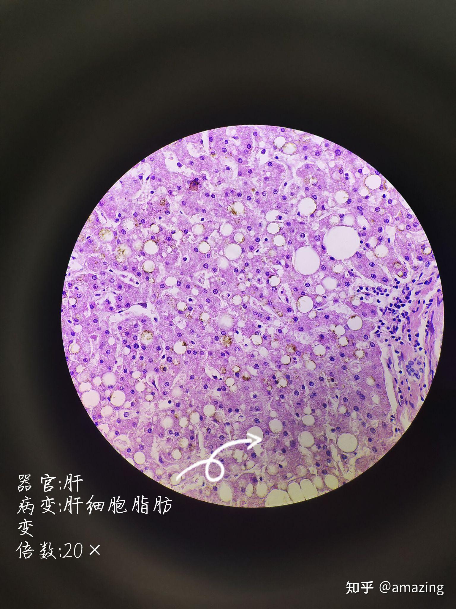 硒维康儿童吃多少