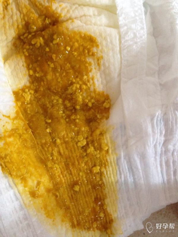 锌硒宝片治疗脱发