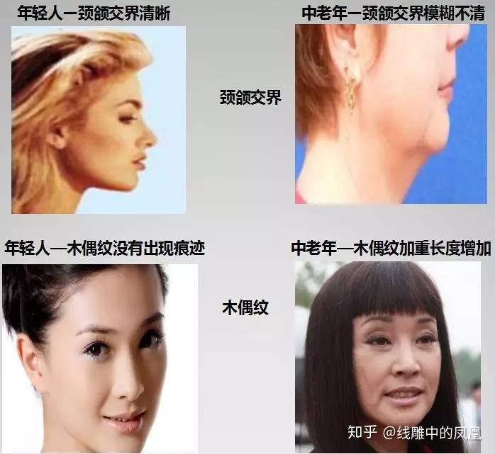 补钙面部会衰老得慢些吗