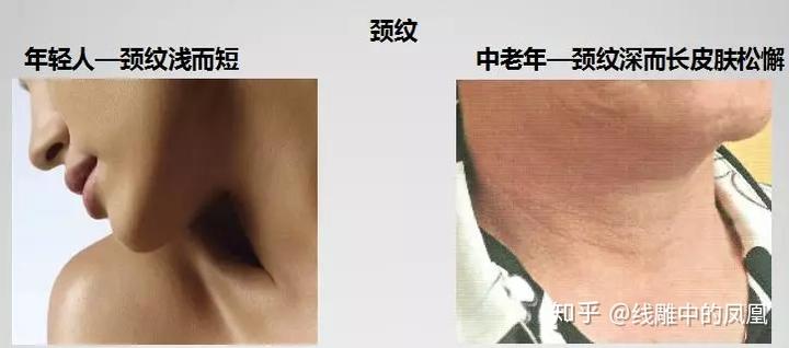补钙面部会衰老得慢些吗