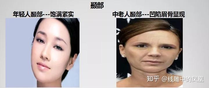 补钙面部会衰老得慢些吗