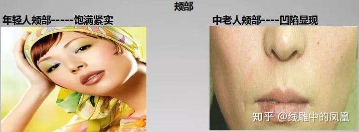 补钙面部会衰老得慢些吗