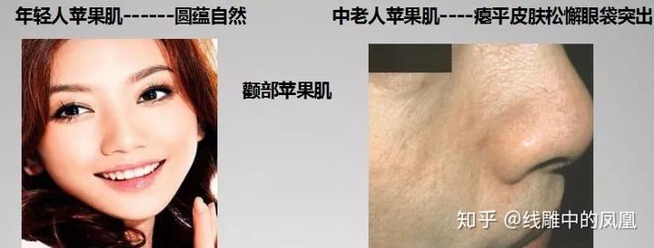补钙面部会衰老得慢些吗