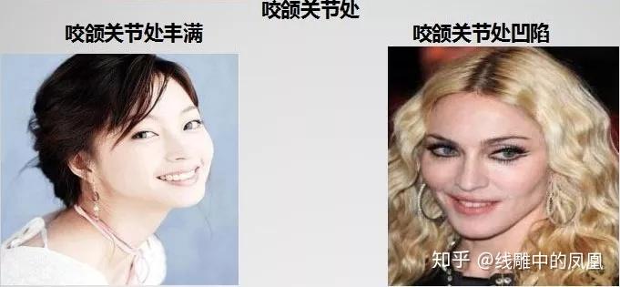 补钙面部会衰老得慢些吗
