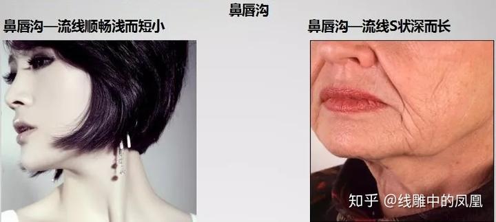 补钙面部会衰老得慢些吗