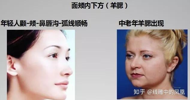 补钙面部会衰老得慢些吗