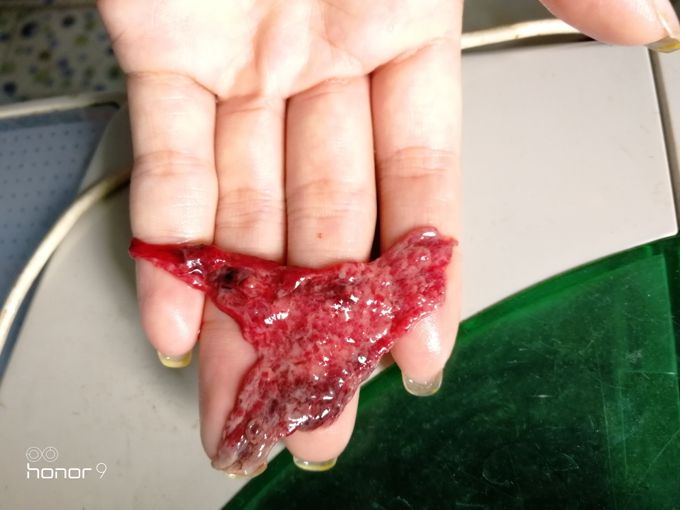 锌硒宝片吃完恶心(吃了锌硒宝可以喝酒吗)-硒宝网