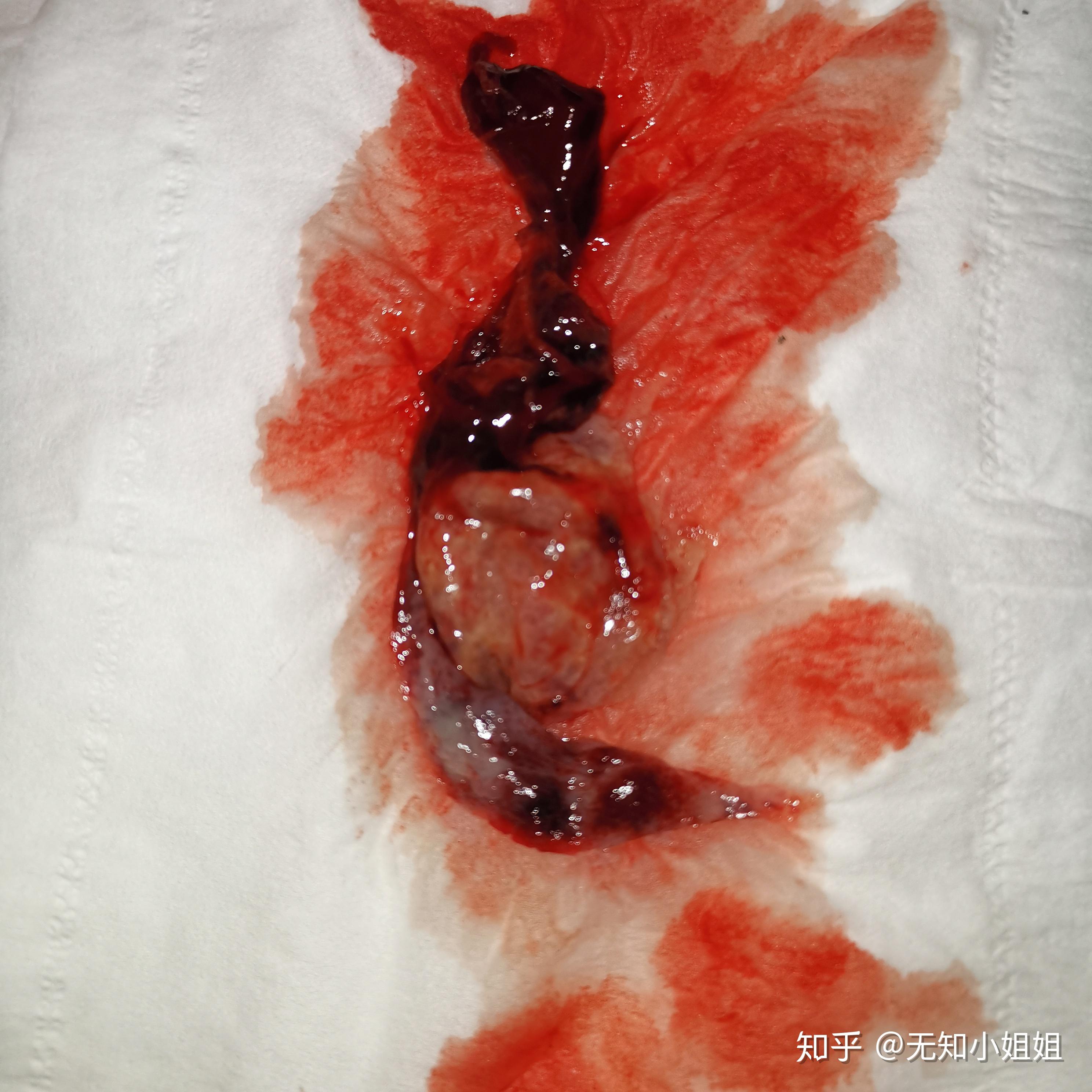 锌硒宝片吃完恶心(吃了锌硒宝可以喝酒吗)-硒宝网