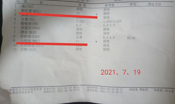 吃锌硒宝小便很黄