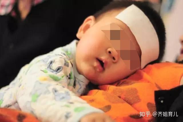 身体缺少微量元素的表现