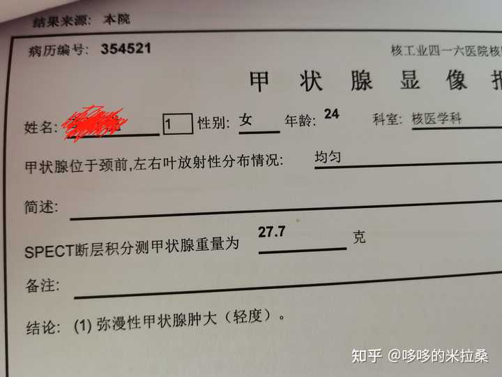白癜风的人能补硒吗(补硒能预防什么疾?。?硒宝网