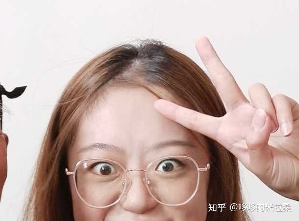 白癜风的人能补硒吗(补硒能预防什么疾?。?硒宝网