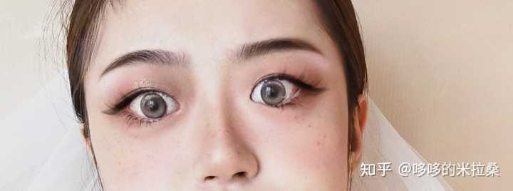 白癜风的人能补硒吗(补硒能预防什么疾?。?硒宝网