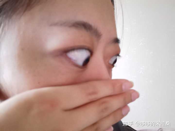 白癜风的人能补硒吗(补硒能预防什么疾?。?硒宝网