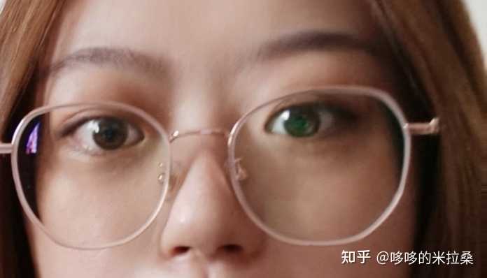 白癜风的人能补硒吗(补硒能预防什么疾病)-硒宝网