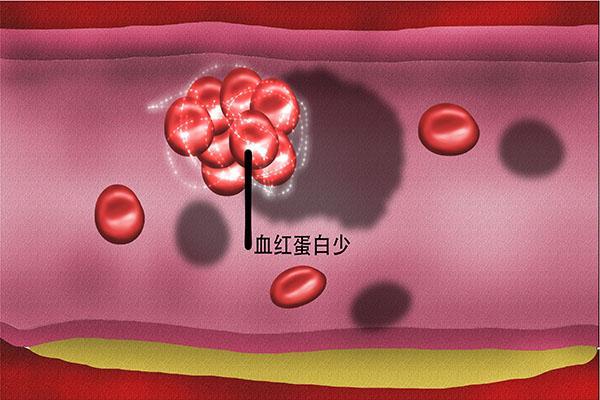 口服补铁(口服补铁的注意事项有哪些)-硒宝网