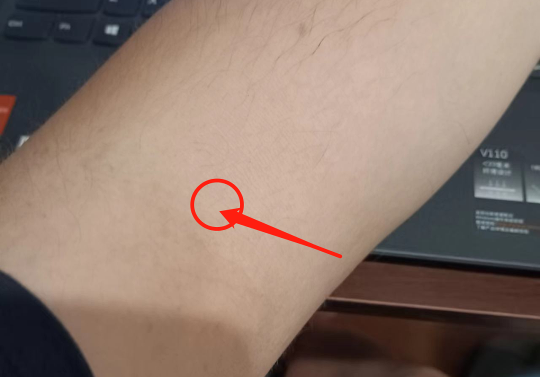 锌硒补多了会嗜睡吗