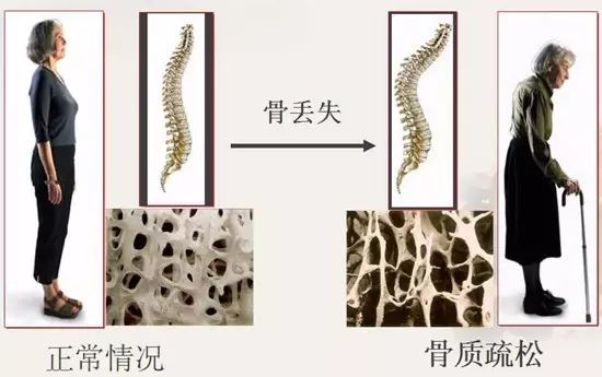 女性补钙