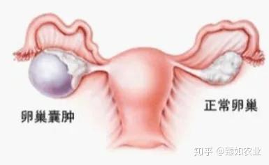肿瘤患者补硒 研究
