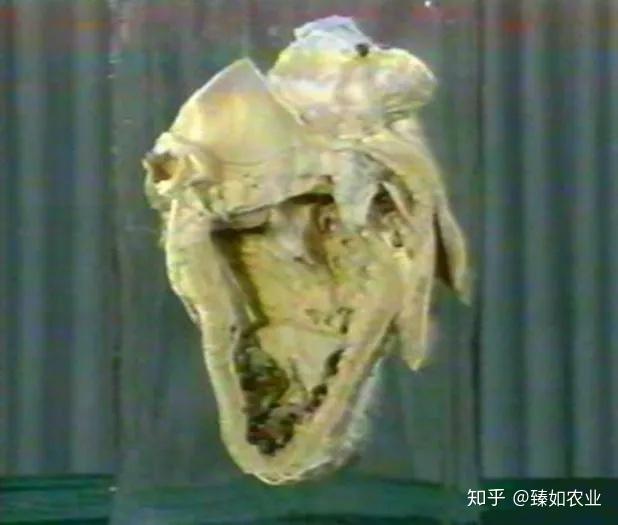 人体补200微克硒