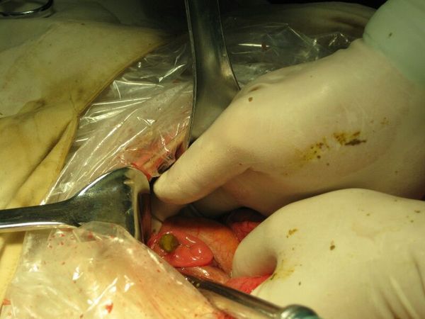 补硒能治hpv 吗
