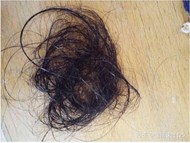 服药期间可以补硒吗