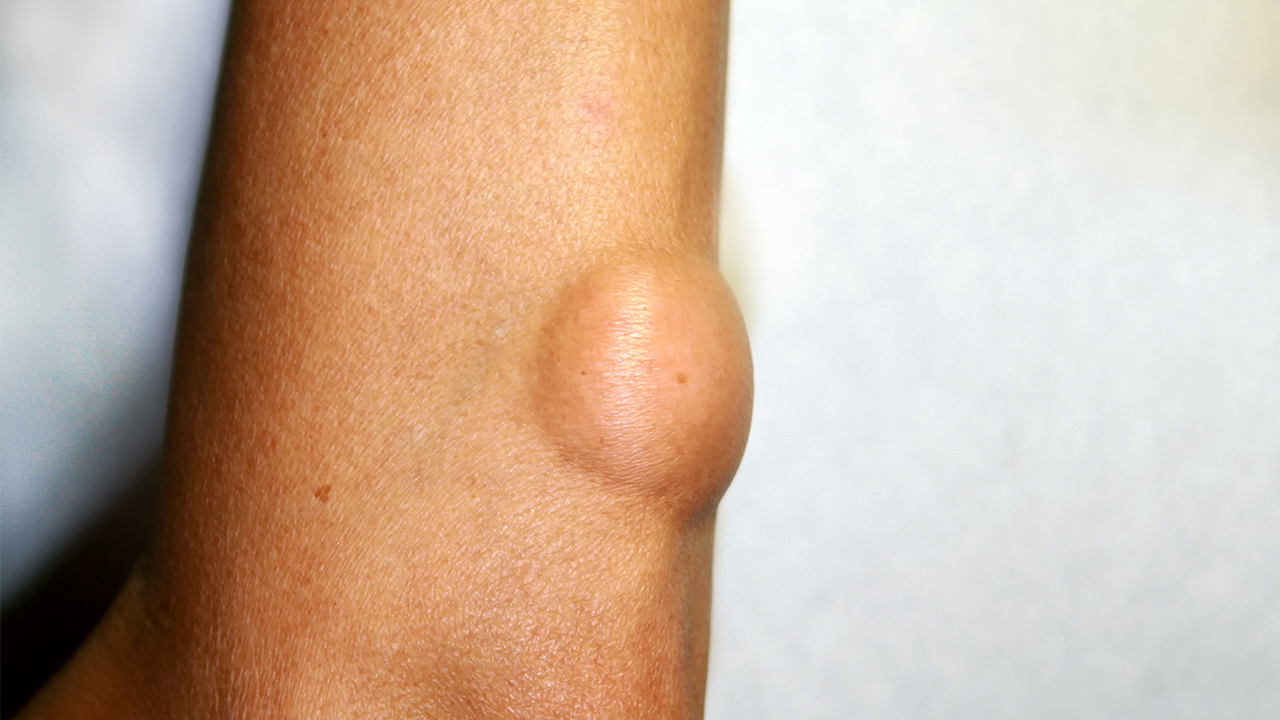 补铁吃什么食物(吃补铁的食物有什么好处)-硒宝网