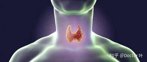 甲状腺结节3类补硒