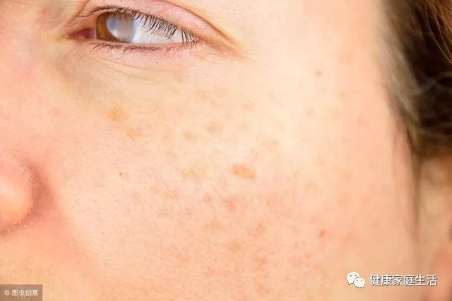 补硒后hpv还复发(吃硒可以治疗hpv吗)-硒宝网