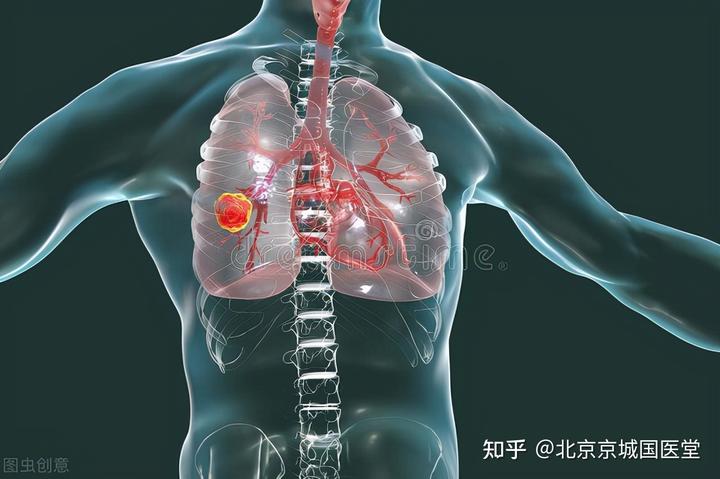 肺癌术后吃什么补硒
