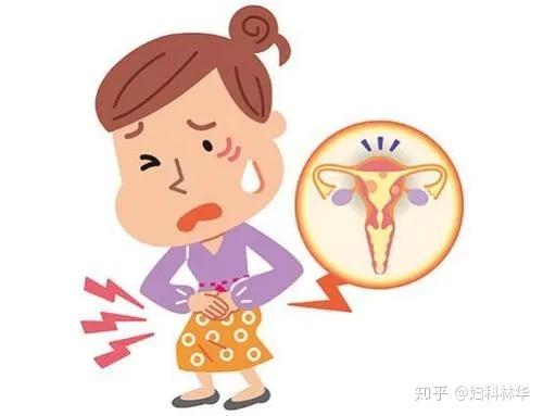 子宫肌瘤需要补硒嘛