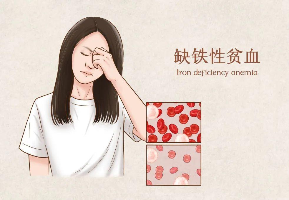 吃什么药补铁