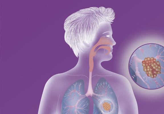 甲亢治疗补硒推荐药(甲亢补硒的药)-硒宝网