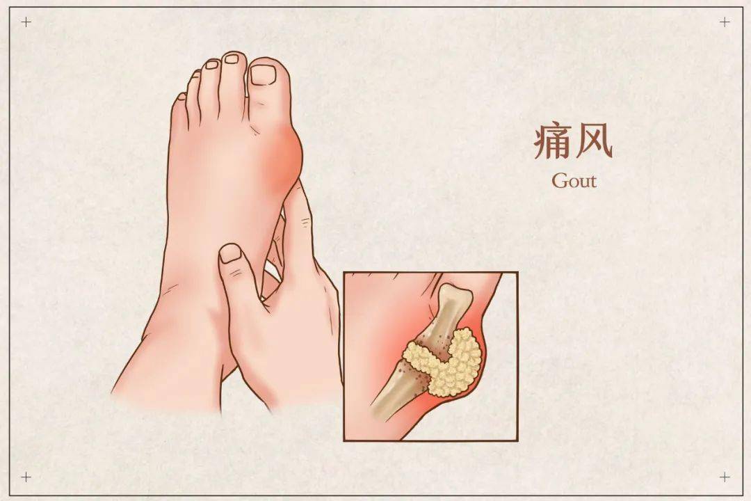 奶茶补钙吗