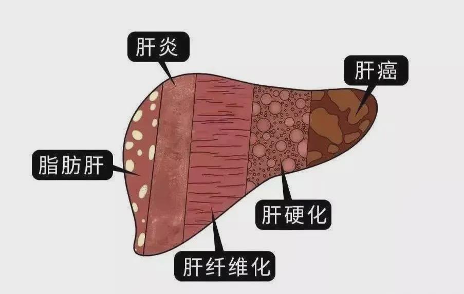 肝不好要补什么硒好