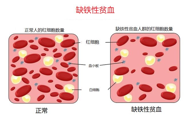 什么时候需要补硒呢